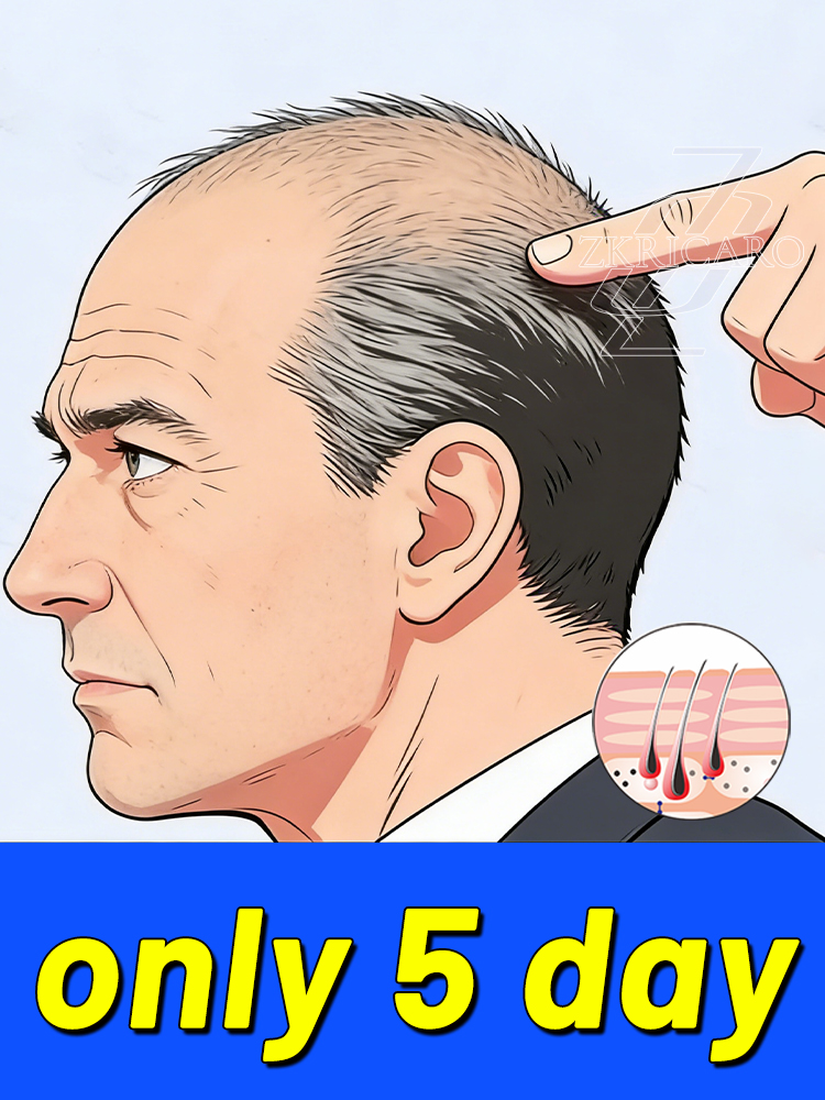 Hair Care Good Hair - สเปรย์จากพืช รุ่นที่สี่ การดูดซึมของนวด วิธีดูแลเส้นผมที่ดี