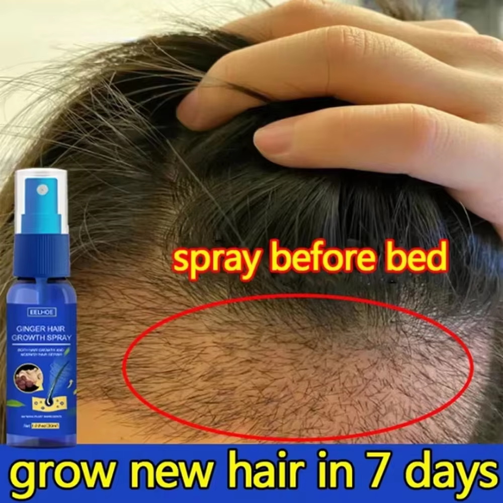 Hair Growth Serum Oil - สเปรย์เร่งผมยาวขึ้นอย่างรวดเร็ว บำรุงรากผม ป้องกันผมร่วง เซรั่มปลูกผมใหม่ ซ่อมแซมหนังศีรษะที่เสียหาย บำรุงและดูแลเส้นผม