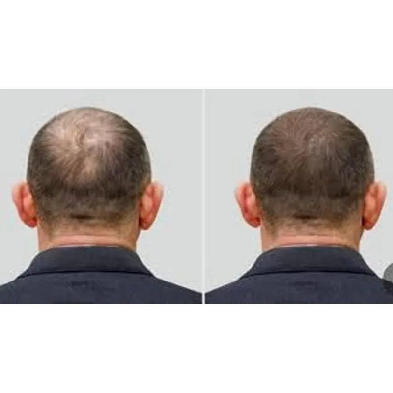 หมวกโอโซน Good Seal สำหรับการด - Hair Care Good Hair บทวิจารณ์และราคา